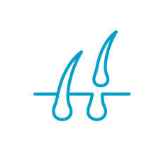 炭酸ガスレーザ